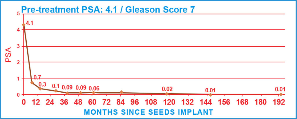 Pre-treatment PSA: 4.1 / Gleason Score 7