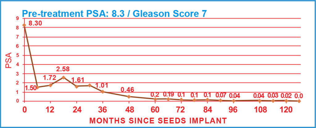 Pre-treatment PSA: 8.3 / Gleason Score 7
