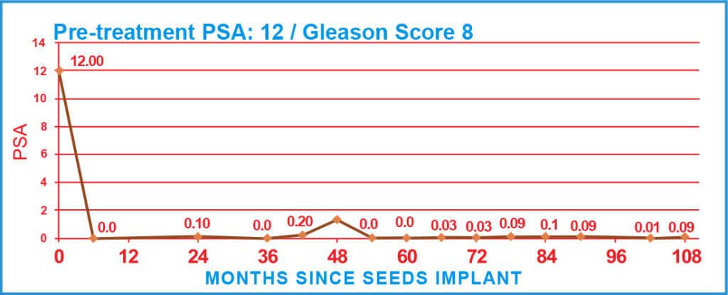 Pre-treatment PSA: 12 / Gleason Score 8
