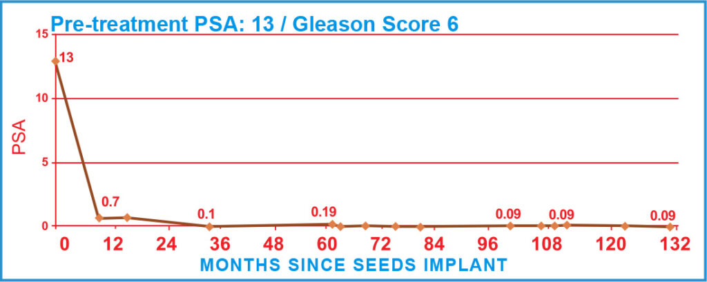 Pre-treatment PSA: 13 / Gleason Score 6