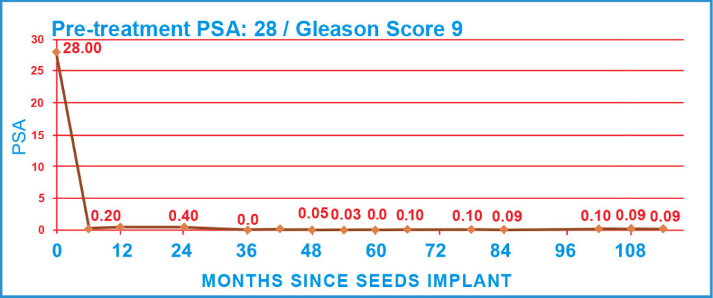 Pre-treatment PSA: 28 / Gleason Score 9