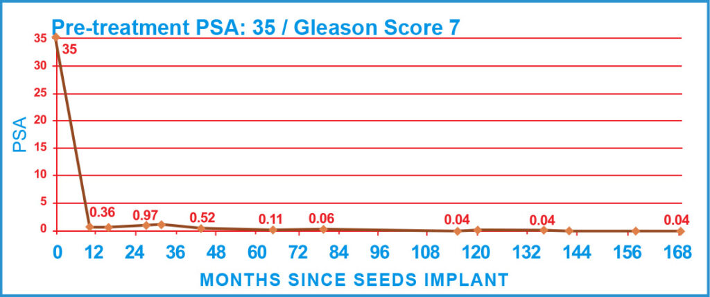 Pre-treatment PSA: 35 / Gleason Score 7