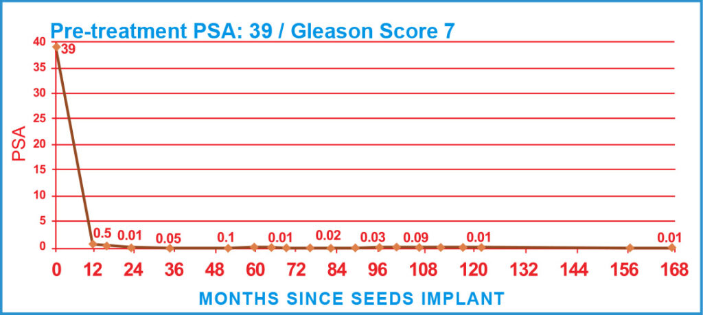 Pre-treatment PSA: 39 / Gleason Score 7